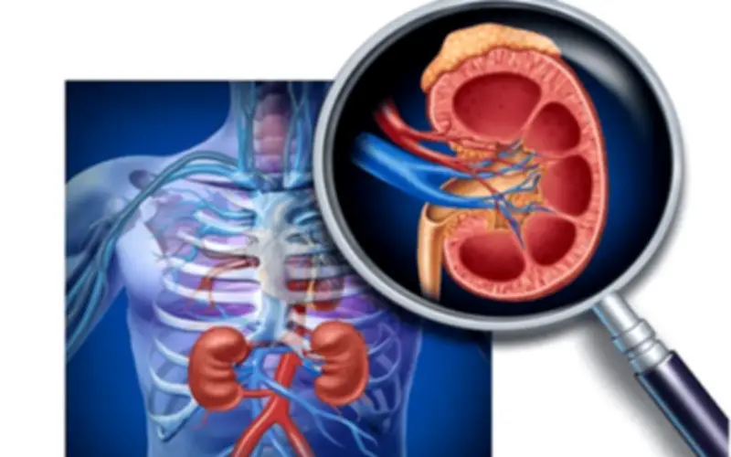 6 Nguyên Tắc Sống Còn Cho Người Bệnh Suy Thận Để Bảo Vệ Chức Năng Thận