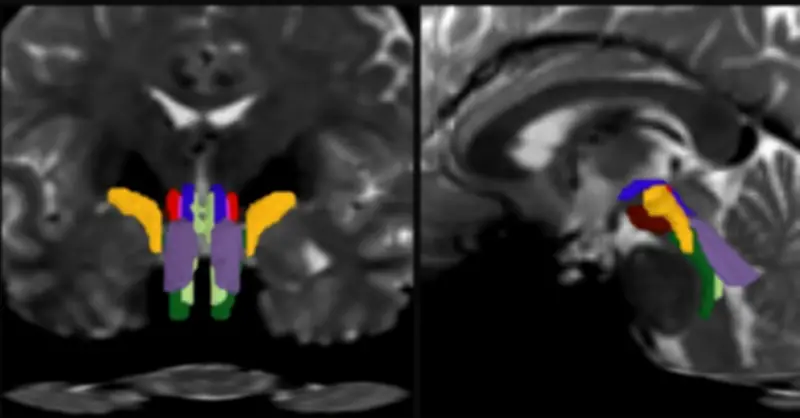 AI giải mã thân não: Công cụ BSBT phát hiện dấu ấn bệnh Parkinson, Alzheimer và theo dõi hồi phục hôn mê