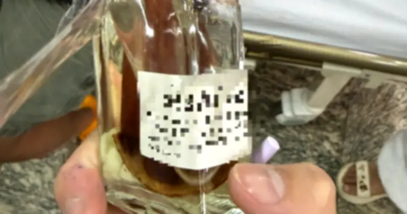 Bé 4 tuổi nguy kịch vì nuốt dầu thơm, bác sĩ cảnh báo nguy cơ từ tinh dầu