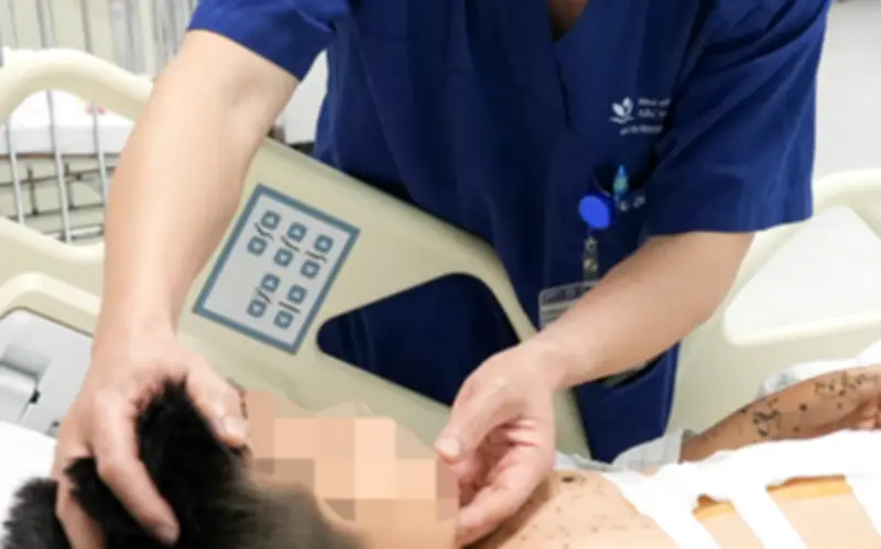 Bé trai 9 tuổi nguy kịch vì kíp nổ tự chế: Cảnh báo từ Bệnh viện Nhi Trung ương