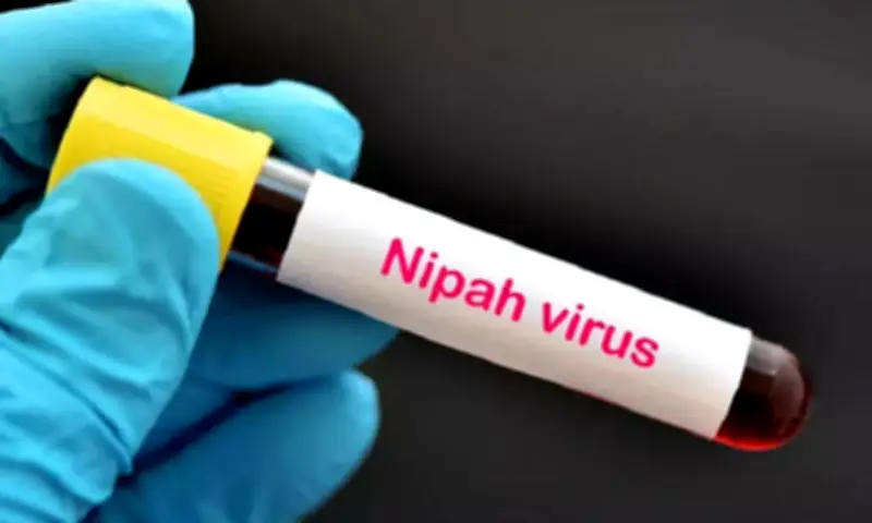 Bộ Y tế ban hành hướng dẫn chẩn đoán và điều trị bệnh do virus Nipah