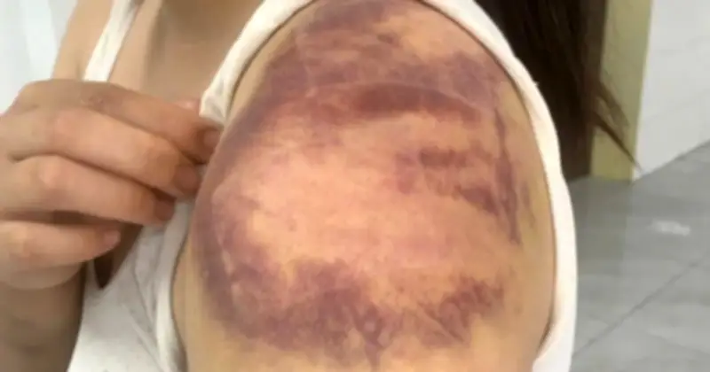 Bắc Ninh: Bố đẻ trói, đánh con gái 13 tuổi và vợ đang mang thai bị tạm giữ