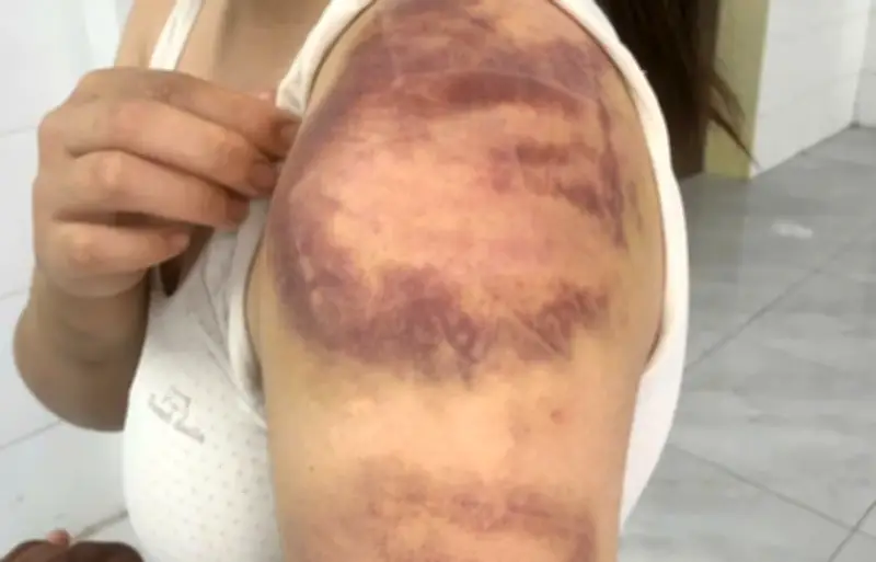 Bắc Ninh: Bắt tạm giam người đàn ông hành hạ vợ và con gái 13 tuổi