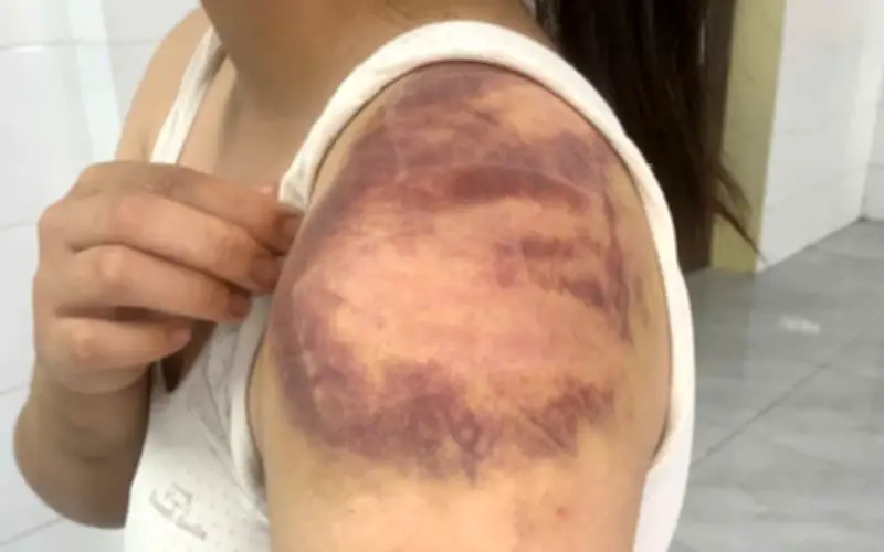 Bắc Ninh: Tạm giữ hình sự đối tượng ngược đãi, hành hạ vợ và con gái 13 tuổi