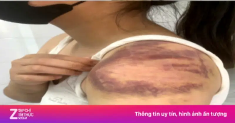 Bắc Ninh tạm giữ người đàn ông bạo hành vợ mang thai và con gái 13 tuổi