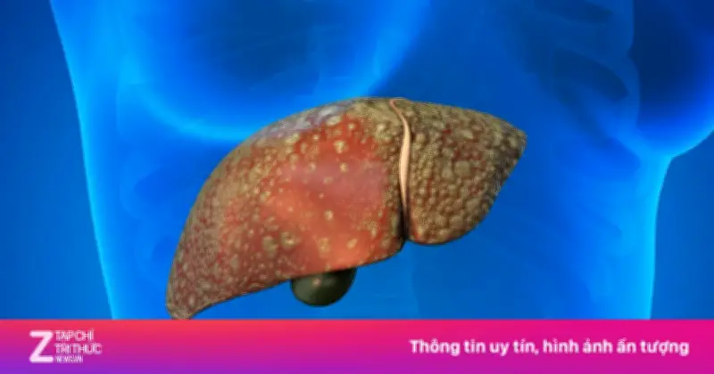 Bệnh Gan Tăng Vọt Sau Tết: Bác Sĩ Cảnh Báo Thói Quen 'Bức Tử' Nội Tạng