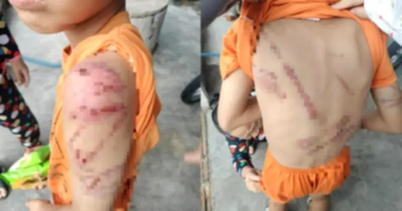 Bé trai 10 tuổi ở Đắk Lắk bị bố ruột bạo hành, công an vào cuộc điều tra