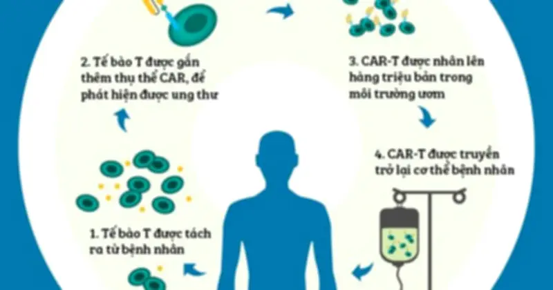 Liệu pháp CAR-T: 'Thuốc sống' đột phá trong điều trị ung thư máu tại Việt Nam