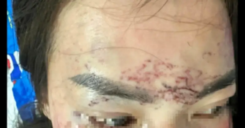 Chủ cơ sở thẩm mỹ đánh ghen, bắt giữ người trái pháp luật sắp ra tòa xét xử