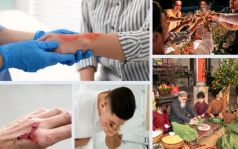 Cảnh báo: Những tai nạn sinh hoạt phổ biến ngày Tết và cách sơ cứu đúng