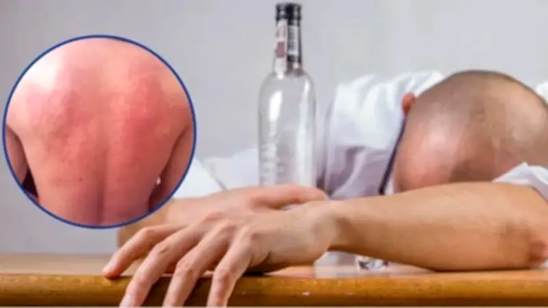 Cảnh báo sai lầm khi giải rượu và cách bảo vệ gan an toàn
