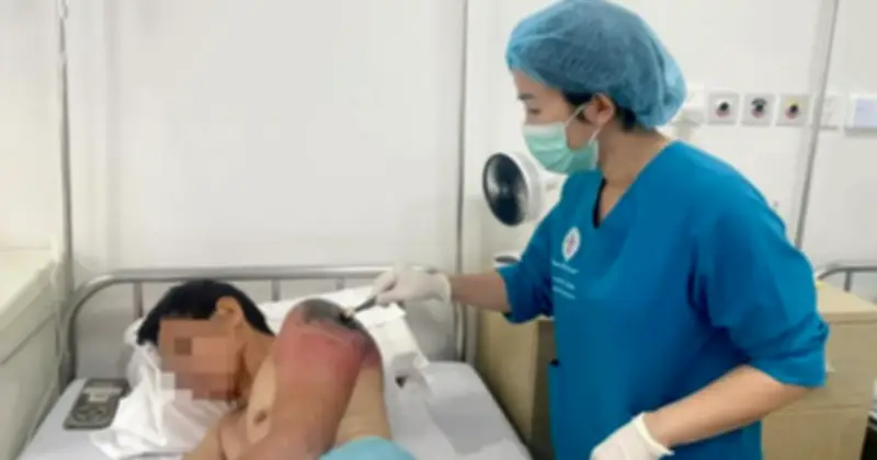 Cảnh báo từ bác sĩ: Đắp lá chữa chấn thương có thể gây nhiễm trùng nặng