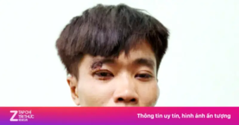 Cảnh Sát An Giang Truy Bắt Thành Công Đối Tượng Trộm Ôtô Tải Trị Giá 300 Triệu Đồng