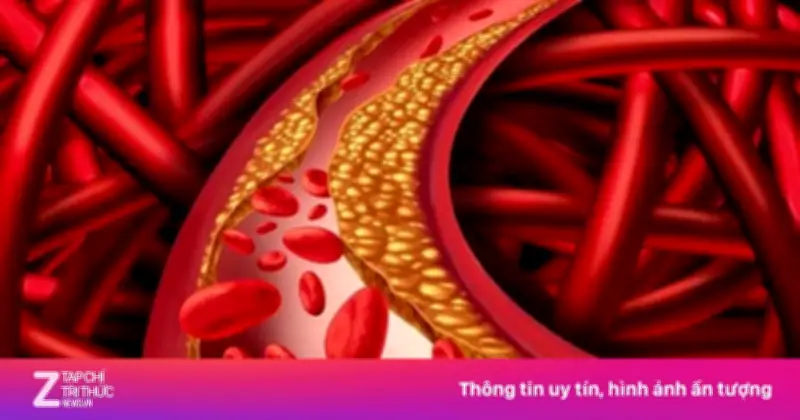 Cách Ăn Uống Giảm Mỡ Máu Xấu, Phòng Ngừa Đột Quỵ Hiệu Quả