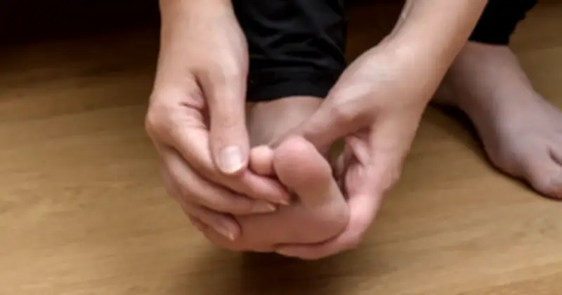 Da chân khô nứt nẻ có thể là dấu hiệu cảnh báo sớm bệnh gan