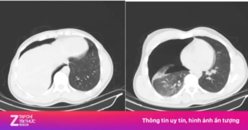 Bác sĩ TP.HCM xuyên đêm cứu du khách Nga bị đa chấn thương nguy kịch