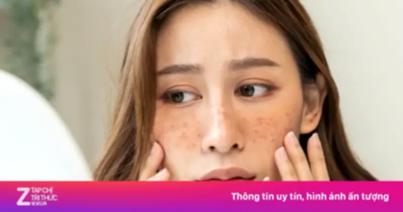 Dấu hiệu cảnh báo cơ thể thiếu magiê trầm trọng qua những bất thường trên khuôn mặt