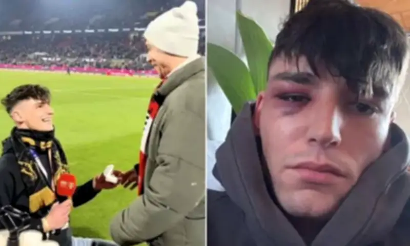 Trọngài Đức bị hành hung sau màn cầu hôn đồng giới gây xúc động tại Bundesliga
