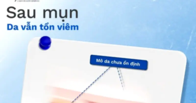 Giải mã cơ chế thâm sẹo sau mụn và gợi ý routine phục hồi da hiệu quả