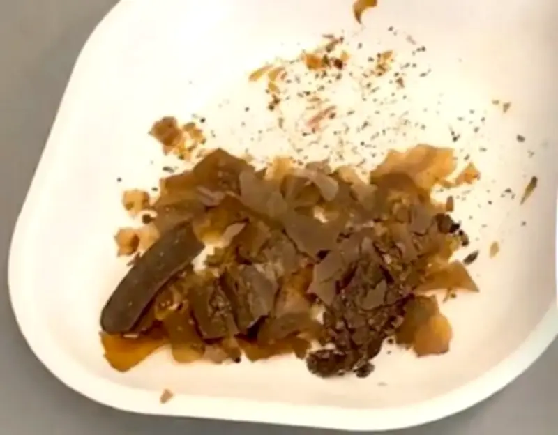 Khám phá mới về phương pháp y học cổ đại của người La Mã