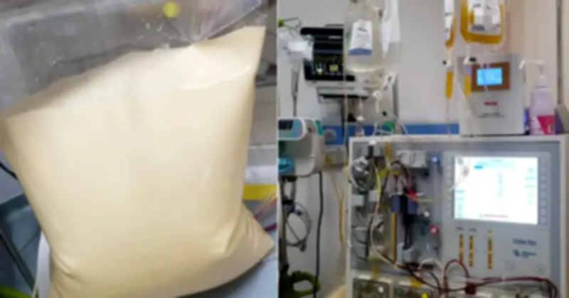 Nam Thanh Niên 25 Tuổi Cấp Cứu Vì 'Máu Sữa' Từ Thói Quen Ăn Uống Thiếu Kiểm Soát