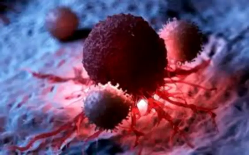 Người đàn ông 67 tuổi phát hiện ung thư phổi từ dấu hiệu nhiều người Việt mắc phải