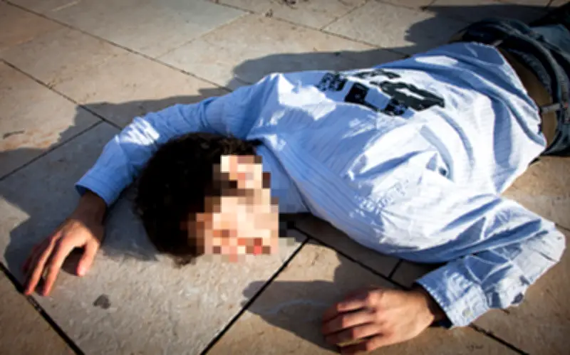 Người đàn ông Trung Quốc nguy kịch sau khi sặc trân châu trà sữa, cấp cứu 21 ngày