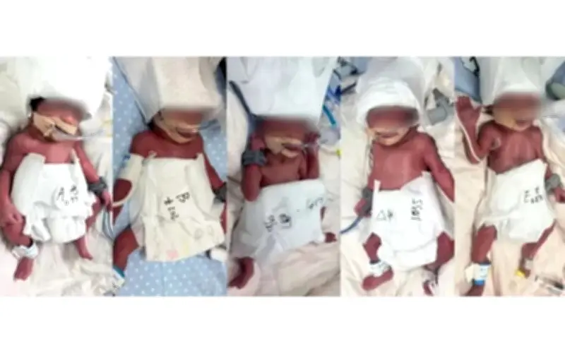 Người phụ nữ Tân Cương sinh 5 con cùng lúc tại Vũ Hán, xác suất cực hiếm