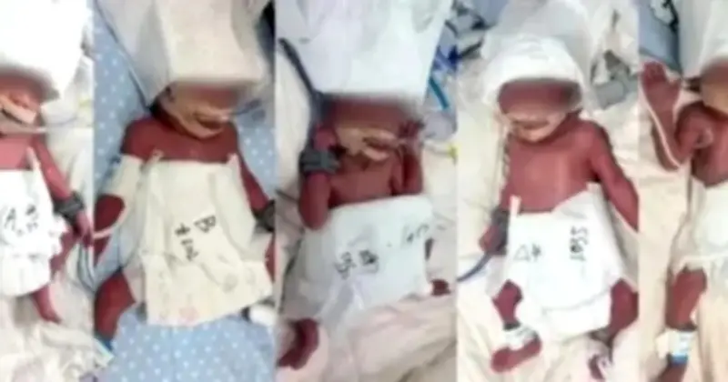 Người Phụ Nữ Tân Cương Sinh Năm Con Cùng Lúc Tại Vũ Hán, Xác Suất Chỉ 1/60 Triệu