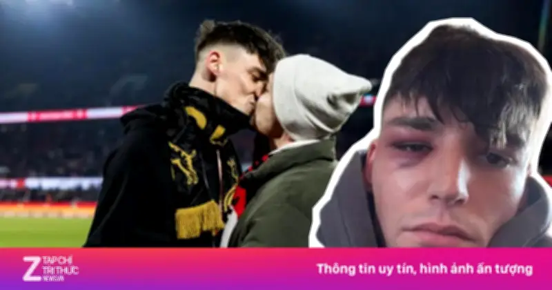 Trọng tài Pascal Kaiser bị hành hung sau màn cầu hôn bạn trai gây xúc động