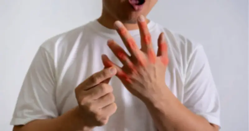 Sau kỳ nghỉ lễ dài, cảnh báo 3 bệnh chuyển hóa nguy hiểm dễ bùng phát