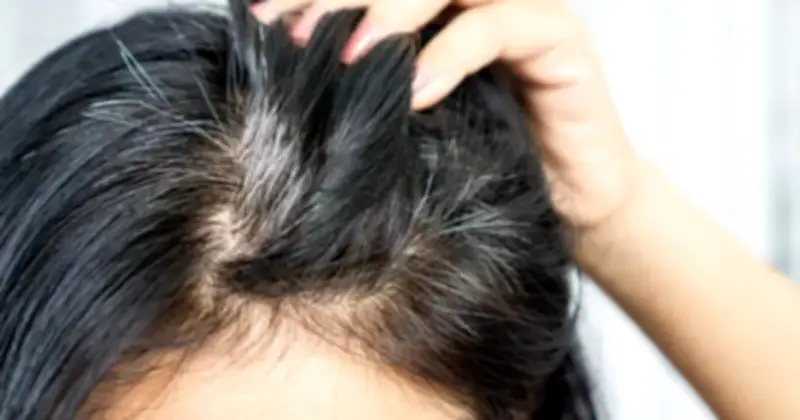 Tóc Bạc Có Thực Sự Giảm Nguy Cơ Ung Thư? Khoa Học Giải Mã Bí Ẩn