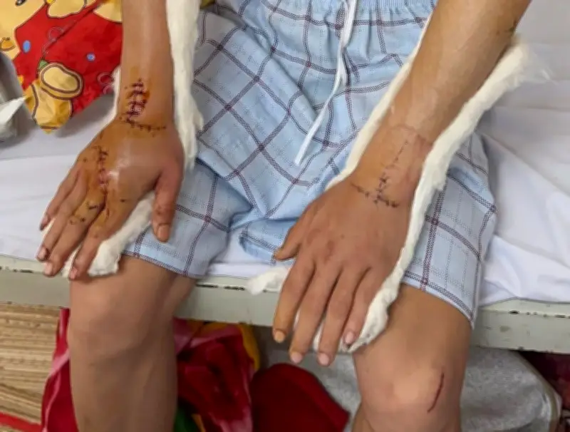 Thanh niên bị nhóm cướp tấn công trên đường về quê ăn Tết, xuất viện sau hơn 10 ngày