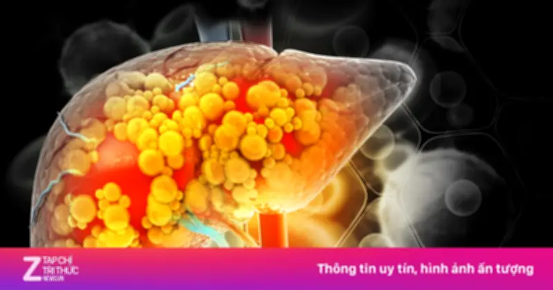 Thói quen xấu khó bỏ gây tổn thương gan nghiêm trọng, nhiều người vẫn làm hàng ngày