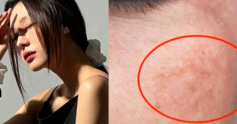 Top 4 Serum Giảm Nám, Làm Sáng Da Hiệu Quả Nhất Thị Trường