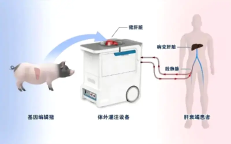 Trung Quốc đảo ngược suy gan cấp bằng gan lợn chỉnh sửa gien ngoài cơ thể