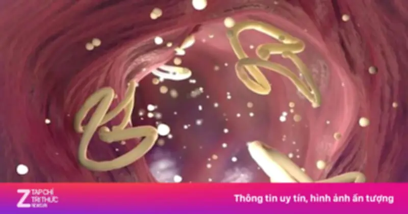 Tẩy giun định kỳ: Bảo vệ sức khỏe toàn diện cho cả gia đình