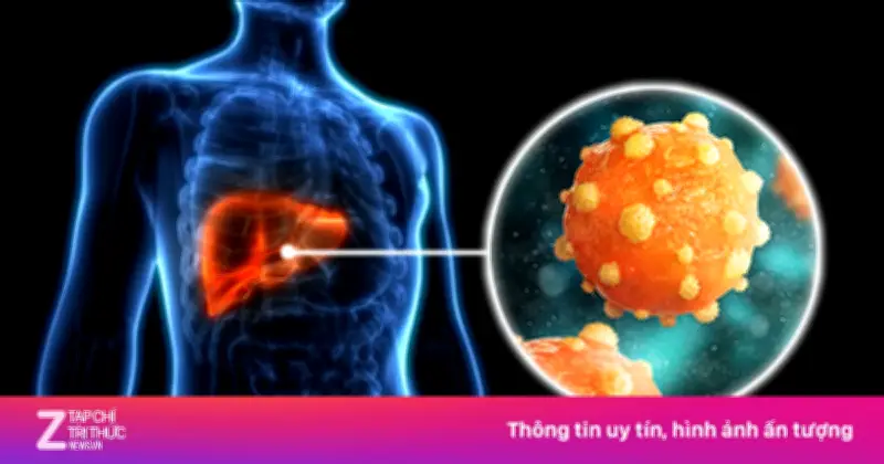 Viêm gan B, C: Dấu hiệu âm thầm và nguy cơ ung thư gan tại Việt Nam