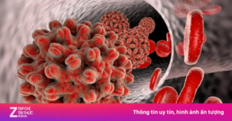 Viêm Gan B: Ngăn Lây Từ Mẹ Sang Con - Chìa Khóa Giảm Ca Bệnh Mạn Tính