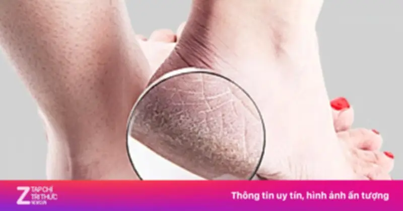 Dấu hiệu cảnh báo cơ thể thiếu vitamin E và cách bổ sung hiệu quả