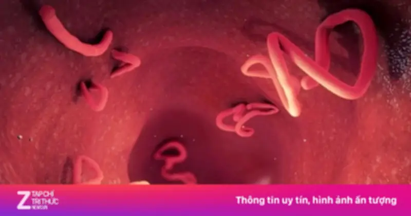 Điều Gì Thực Sự Xảy Ra Trong Cơ Thể Sau Khi Uống Thuốc Xổ Giun?