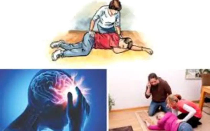 Đột Quỵ Não Gia Tăng Mạnh Dịp Tết: Cảnh Báo Nguy Cơ Và Cách Phòng Ngừa