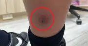 Bác sĩ cứu sống bé trai nhờ phát hiện dấu hiệu lạ từ cơn đau chân