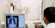 Bộ Y tế chấn chỉnh việc từ chối thanh toán BHYT dựa trên thời gian chụp X-quang