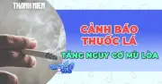 Cảnh báo: Thuốc lá làm tăng nguy cơ mù lòa, nghiên cứu mới công bố