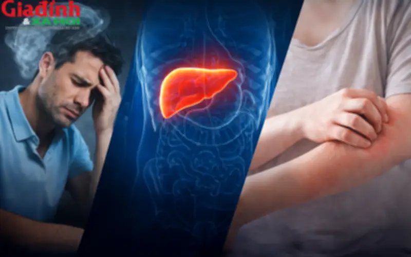 3 Dấu Hiệu Cảnh Báo Cơ Thể Quá Tải, Sắp Vượt Ngưỡng Chịu Đựng