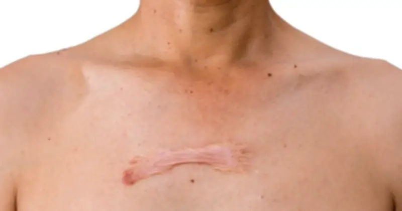 30-50% nguy cơ SEO lỗi xuất phát từ yếu tố ít được nhắc đến