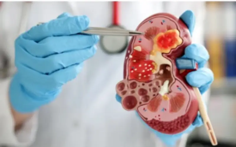 7 Loại Trái Cây Tốt Cho Thận, Người Bệnh Suy Thận Nên Ăn Để Duy Trì Chức Năng