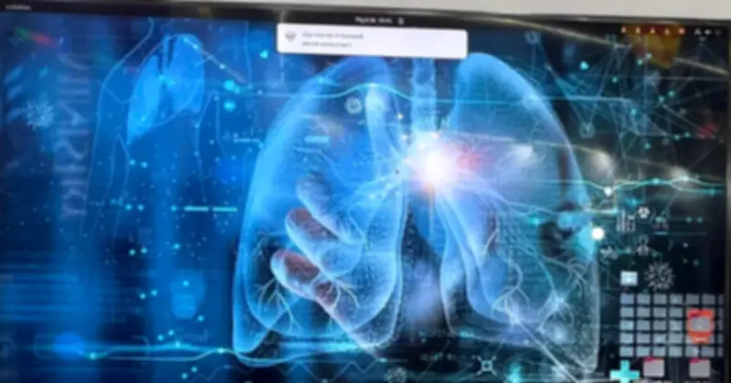 AI hỗ trợ phát hiện ung thư phổi giai đoạn rất sớm, tăng cơ hội điều trị