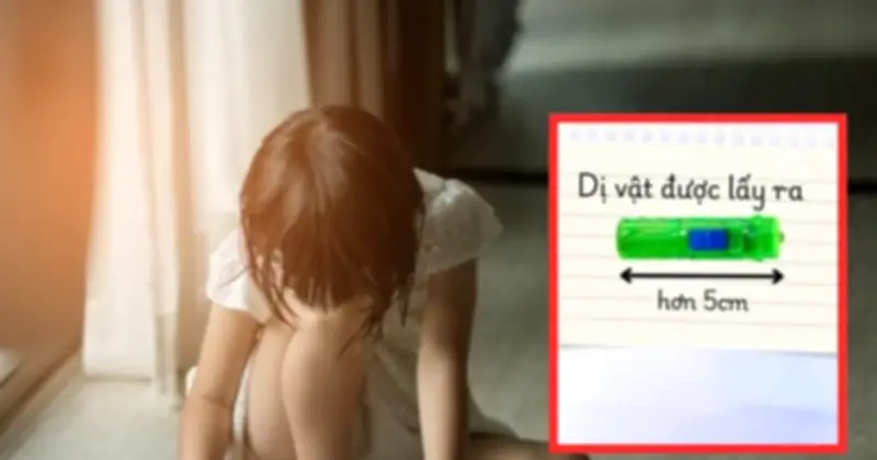 Bé gái Hà Nội nhiều tháng viêm nhiễm vùng kín, nguyên nhân là đèn pin đồ chơi